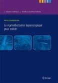 Précis d'intervention. La sigmoïdectomie laparoscopique pour cancer (eBook, PDF)