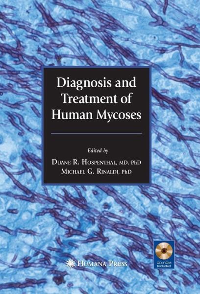 Diagnosis and Treatment of Human Mycoses (eBook, PDF)