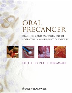 Oral Precancer (eBook, ePUB)