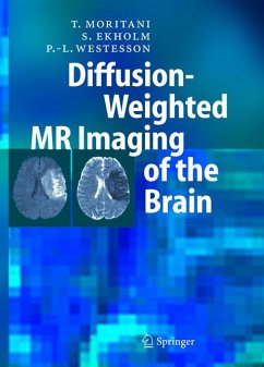 Diffusion-Weighted MR Imaging of the Brain (eBook, PDF) - Moritani, T.; Ekholm, S.; Westesson, P.-L.