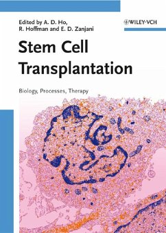 Cover Stem Cell Transplantation (eBook, PDF)