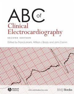 Cover ABC of Clinical Electrocardiography (eBook, PDF)