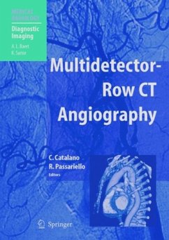 Multidetector-Row CT Angiography (eBook, PDF)