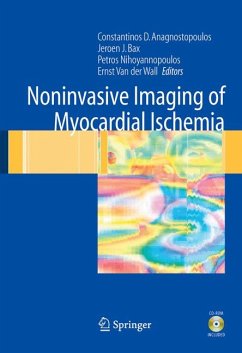 Noninvasive Imaging of Myocardial Ischemia (eBook, PDF)