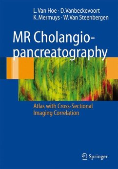 MR Cholangiopancreatography (eBook, PDF) - van Hoe, L.; Vanbeckevoort, Dirk; Mermuys, Koen; Steenbergen, Werner van