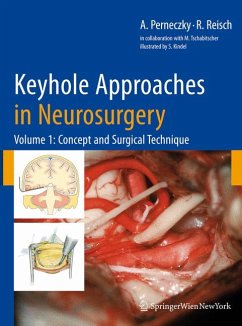 Keyhole Approaches in Neurosurgery (eBook, PDF) - Perneczky, Axel; Reisch, Robert