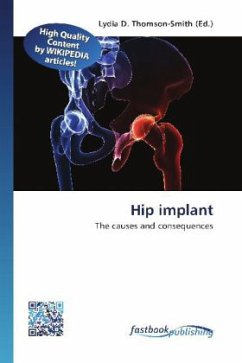 Hip implant