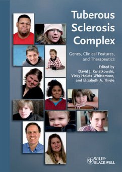 Tuberous Sclerosis Complex (eBook, ePUB)