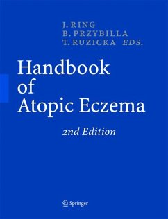 Handbook of Atopic Eczema (eBook, PDF)