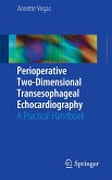 Perioperative Two-Dimensional Transesophageal Echocardiography (eBook, PDF)