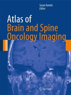 Atlas of Brain and Spine Oncology Imaging (eBook, PDF)