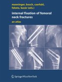 Internal fixation of femoral neck fractures (eBook, PDF)
