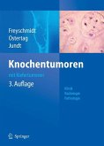 Knochentumoren mit Kiefertumoren (eBook, PDF)