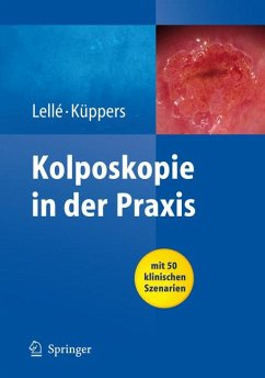 Kolposkopie in der Praxis (eBook, PDF) - Lellé, Ralph J.; Küppers, Volkmar
