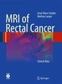 MRI of Rectal Cancer (eBook, PDF)