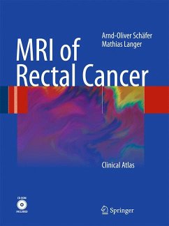 MRI of Rectal Cancer (eBook, PDF) - Schäfer, Arnd-Oliver; Langer, Mathias