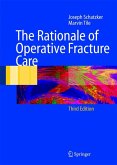 The Rationale of Operative Fracture Care (eBook, PDF)