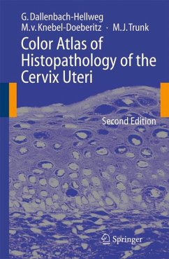 Color Atlas of Histopathology of the Cervix Uteri (eBook, PDF) - Dallenbach-Hellweg, Gisela; Knebel Doeberitz, Magnus; Trunk, Marcus J.