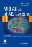MRI Atlas of MS Lesions (eBook, PDF)