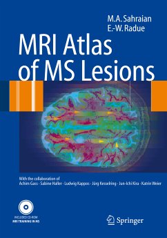 MRI Atlas of MS Lesions (eBook, PDF) - Sahraian, M.A.; Radü, Ernst-Wilhelm