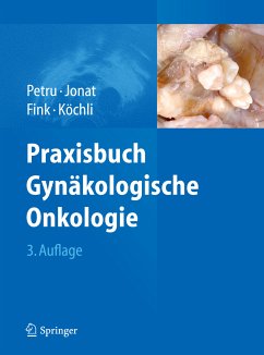 Praxisbuch Gynäkologische Onkologie (eBook, PDF)