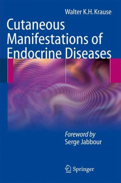 Cutaneous Manifestations of Endocrine Diseases (eBook, PDF) - Krause, Walter K.H.