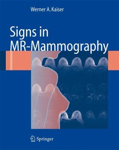 Signs in MR-Mammography (eBook, PDF) - Kaiser, Werner A.