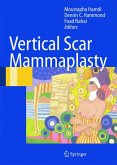 Vertical Scar Mammaplasty (eBook, PDF)