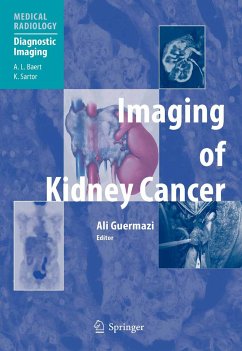 Imaging of Kidney Cancer (eBook, PDF)