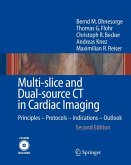 Multi-slice and Dual-source CT in Cardiac Imaging (eBook, PDF)