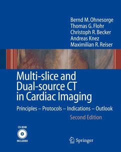 Multi-slice and Dual-source CT in Cardiac Imaging (eBook, PDF) - Ohnesorge, Bernd M.; Flohr, Thomas G.; Becker, Christoph R.; Knez, Andreas; Reiser, Maximilian F