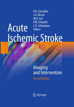 Acute Ischemic Stroke (eBook, PDF)