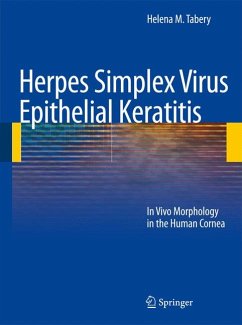 Herpes Simplex Virus Epithelial Keratitis (eBook, PDF) - Tabery, Helena M.