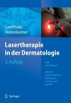 Lasertherapie in der Dermatologie (eBook, PDF) - Landthaler, Michael; Hohenleutner, Ulrich