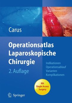 Operationsatlas Laparoskopische Chirurgie (eBook, PDF) - Carus, Thomas