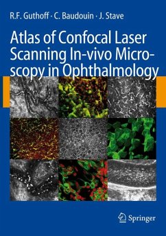 Atlas of Confocal Laser Scanning In-vivo Microscopy in Ophthalmology (eBook, PDF) - Guthoff, R.F.; Baudouin, C.; Stave, J.