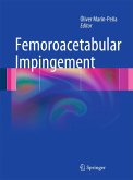 Femoroacetabular Impingement (eBook, PDF)