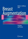 Breast Augmentation (eBook, PDF)