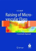 Raising of Microvascular Flaps (eBook, PDF)