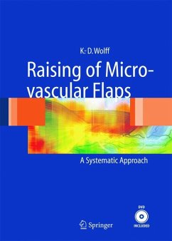 Raising of Microvascular Flaps (eBook, PDF) - Wolff, Klaus-Dietrich; Hölzle, Frank