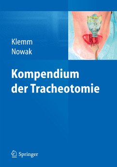 Kompendium der Tracheotomie (eBook, PDF)