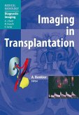 Imaging in Transplantation (eBook, PDF)