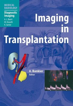 Imaging in Transplantation (eBook, PDF)