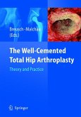 The Well-Cemented Total Hip Arthroplasty (eBook, PDF)