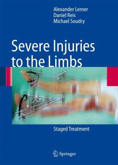 Severe Injuries to the Limbs (eBook, PDF) - Lerner, Alexander; Reis, Daniel; Soudry, Michael