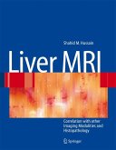 Liver MRI (eBook, PDF)