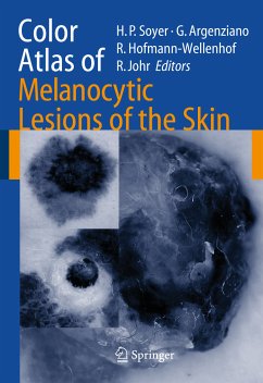 Color Atlas of Melanocytic Lesions of the Skin (eBook, PDF)