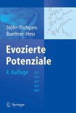 Evozierte Potenziale (eBook, PDF)