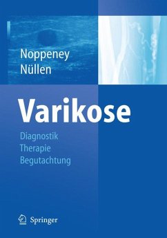 Varikose (eBook, PDF)