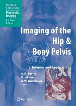 Imaging of the Hip & Bony Pelvis (eBook, PDF)